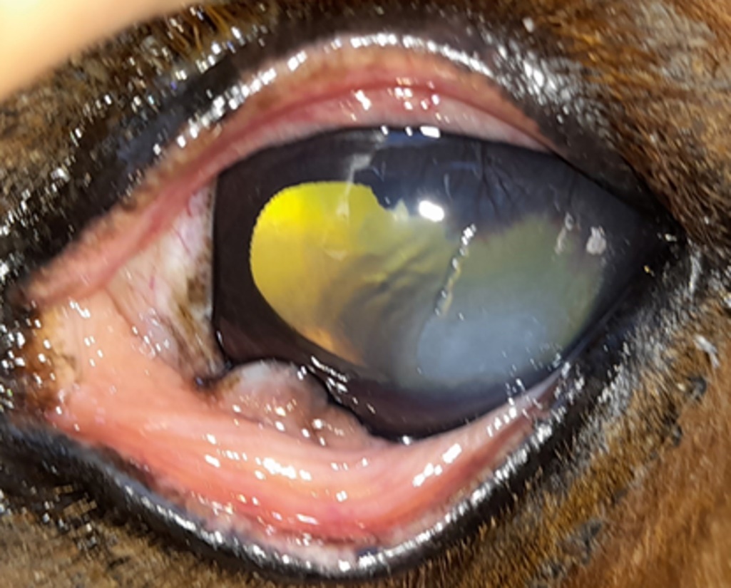 Conjunctival hyperemia, paraxial corneal opacity, covered by a whitish discharge
  with mild vascular reaction, and mydriasis (due to atropine treatment).